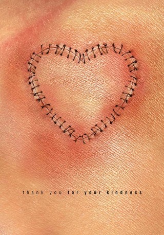 Resul Ay, Organ donation 2