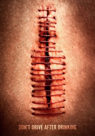 Yong Huang, Drunk wound